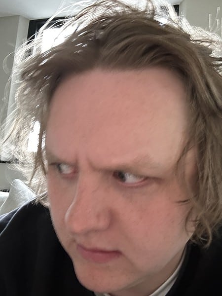 ACERCA DE LA SALUD MENTAL DE LEWIS CAPALDI